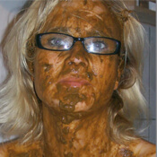 Girl mit Brille mit Kackverschmiertem Gesicht